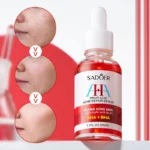 Sadoer AHA + BHA Fruit Acid Acne Repair Serum With Salicylic Acid 30ml