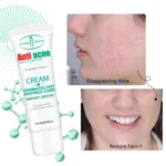 Aichun Beauty Anti Acne Cream 20g