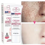 Aichun Beauty Anti Freckle Cream 20g