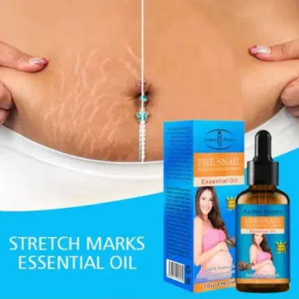 Aichun Beauty Stretch Marks Oil – 3 Days Effective