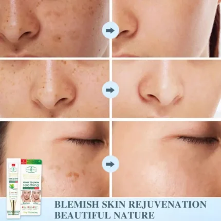 Aichun Beauty Freckle Cream