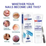 Aichun Beauty Nail Repair Cream Dermatology Inspired Care