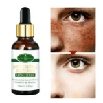 Aichun Beauty Anti Freckle Whitening Facial Serum 30ml